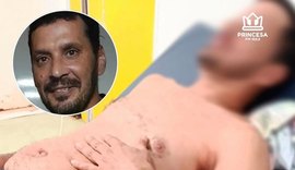 Nando do Reggae passa por cirurgia após ser ferido durante discussão política em Viçosa