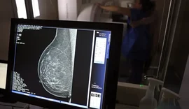 Cerca de 77 mil mulheres aguardam mamografia pelo SUS