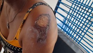 Após ser assaltada e agredida na frente do filho de 4 anos, mulher conta que ficou traumatizada
