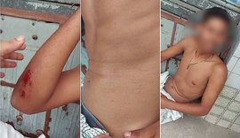Família de jovem espancado se reúne com superintendente do Ronda no Bairro