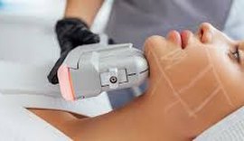 Tecnologia HIFU ganha destaque em tratamentos estéticos em Maceió