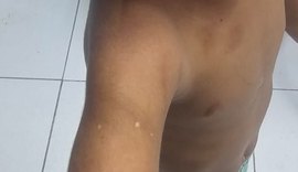 Padrasto e mãe são presos em flagrante por agressão a criança de 3 anos em Maceió