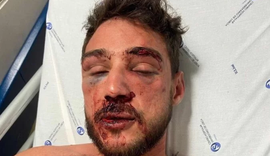 Arapiraquense e companheiro são brutalmente agredidos por seguranças de bar em Lisboa