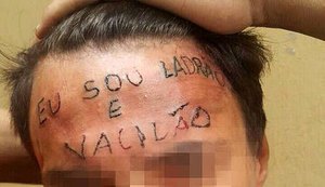 Clínicas e estúdios devem bancar remoção de tatuagem em testa de rapaz