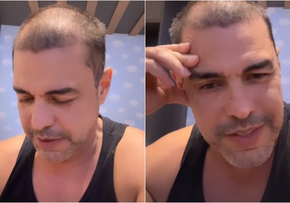 Cantor Zezé di Camargo surge careca em vídeo  e surpreende