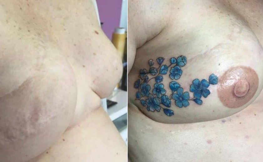 De graça, tatuadora do Paraná cobre cicatrizes de pessoas que tiveram câncer