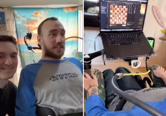 Neuralink faz demonstração com paciente que recebeu 1º implante de chip cerebral