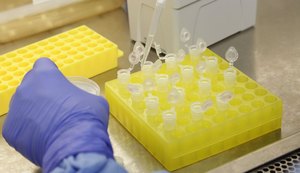 Alagoas tem 18 casos confirmados de Covid-19