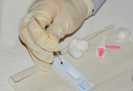 Nova edição do Projeto Alagoas Vigilante vai tratar da Vigilância das Infecções Sexualmente Transmissíveis