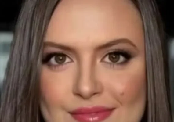 Jovem de 22 anos morre após sofrer reação alérgica durante tomografia com contraste em SC