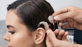 Implante coclear: quem pode fazer a cirurgia que devolve a audição