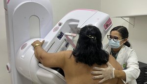 Cedim realiza quase 16 mil mamografias em um ano e reforça importância do exame