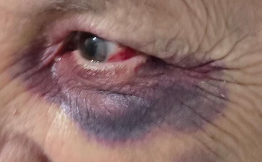 Polícia Civil prende dois homens por violência doméstica em Palmeira dos Índios