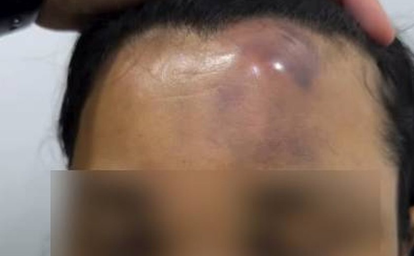 SSP abre investigação sobre denúncia de agressão policial durante festa de São Pedro em Maceió