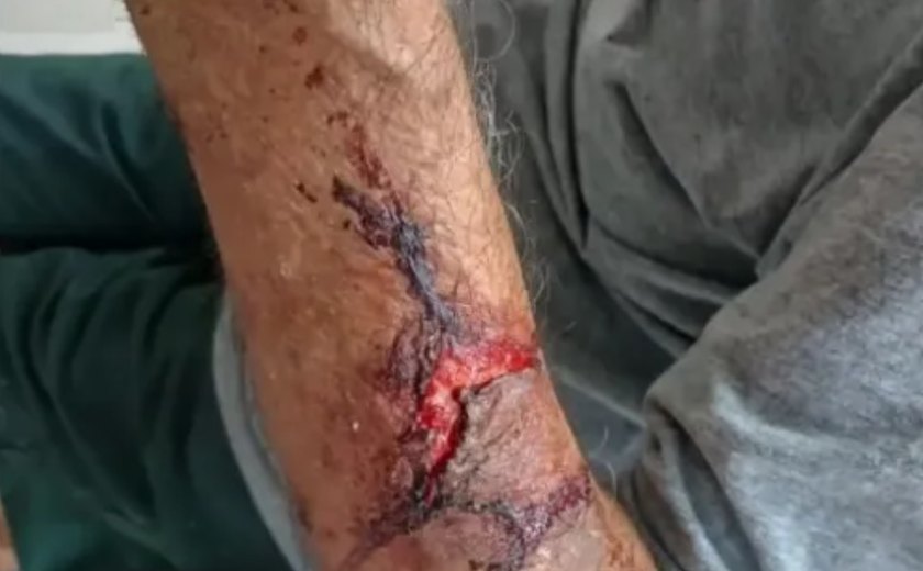 Presa suspeita de assaltar e agredir idoso com capacete em Delmiro Gouveia