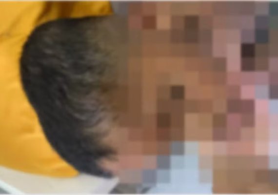 MPAL investiga denúncia de agressões contra criança com autismo em Arapiraca