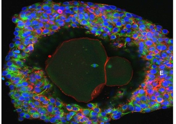 Cientistas desenvolvem óvulos humanos em laboratório até a maturidade