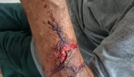 Presa suspeita de assaltar e agredir idoso com capacete em Delmiro Gouveia