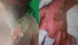 Polícia Civil apura grave caso de violência doméstica contra adolescente em Maravilha