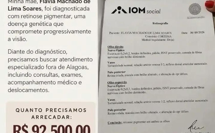 Família alagoana mobiliza campanha solidária para custear atendimento especializado de mulher diagnosticada com doença rara da visão