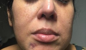 Sima: servidora denuncia agressão no trabalho