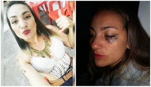 Jovem posta fotos da irmã agredida pelo ex-namorado: 'Não consigo nem olhar para ela'