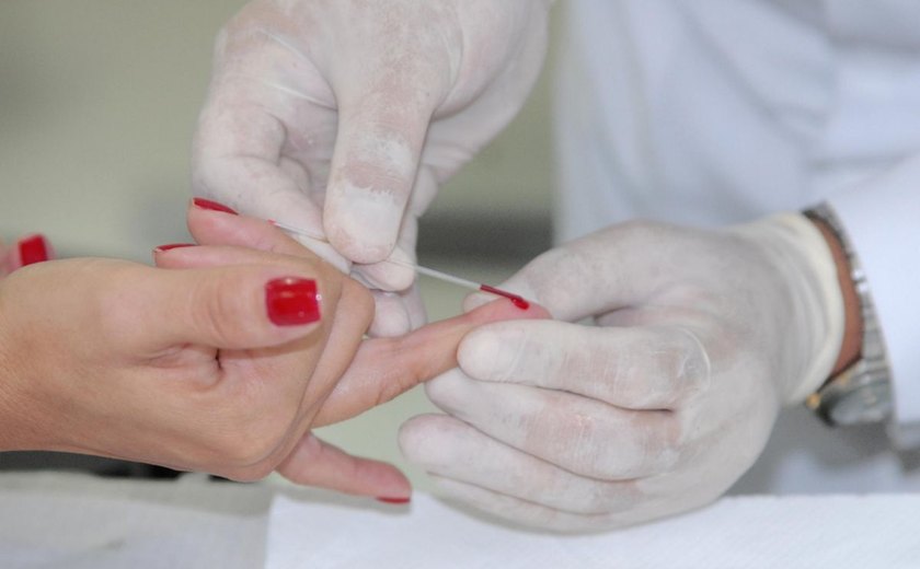 Alagoas registra 832 novos casos de HIV