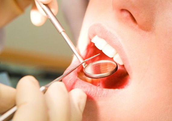 Apenas 37% dos homens frequentam o dentista em Alagoas