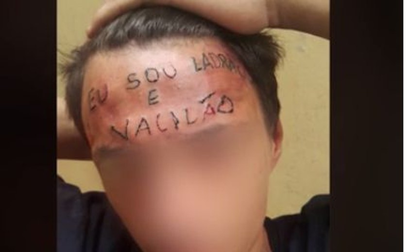 Campanha arrecada R$ 13 mil em um dia para remover tatuagem da testa de jovem