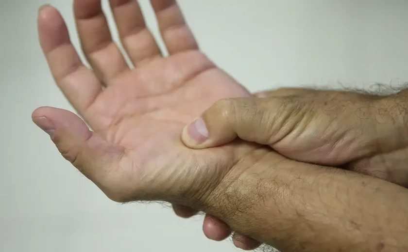 Lei passa a definir fibromialgia como deficiência em todo o país