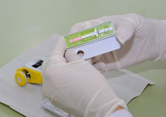Maternidades conveniadas ao SUS em Maceió passam a ofertar Teste Rápido de Zika