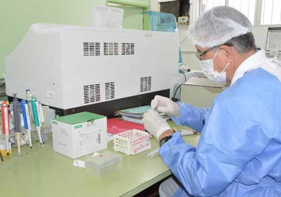 Lacen dobra número de testes para Covid-19