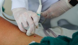 Médica do Hospital Metropolitano de Alagoas alerta para os riscos da esteatose hepática