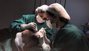  Transplante capilar ganha força em AL com sistema desenvolvido por Hospital Veredas