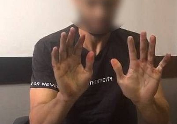 Homem que matou o tio foi preso ainda com as mãos sujas de sangue