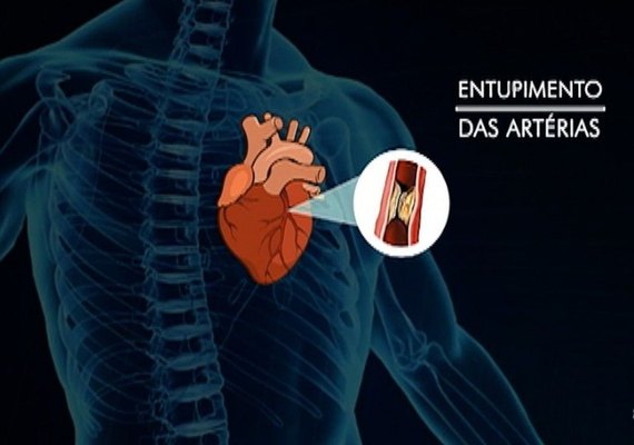 Droga que inativa micróbios no intestino pode prevenir doença cardiovascular