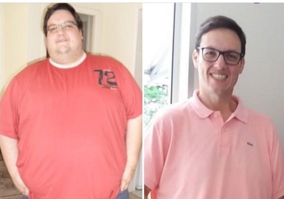 Pesquisas indicam que um em cada quatro brasileiros será obeso em 2030