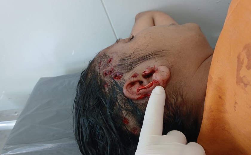 Mulher é agredida por quatro pessoas durante bebedeira em Paulo Jacinto; Polícia Civil investiga o caso
