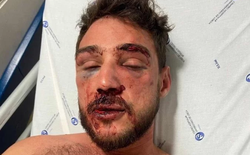 Arapiraquense e companheiro são brutalmente agredidos por seguranças de bar em Lisboa