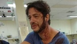 Ator de 'Sandy &amp; Jr' é agredido na cabeça e vai sangrando a hospital