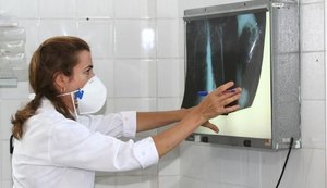 Brasil se aproxima de padrão positivo de combate à tuberculose, mostra relatório