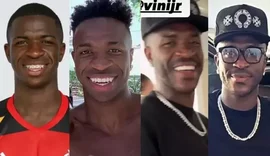 Antes e depois do craque Vini Jr: suposta harmonização, barba, novo sorriso e mais