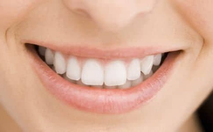 Cremes dentais não resolvem sozinhos erosão dental e hipersensibilidade