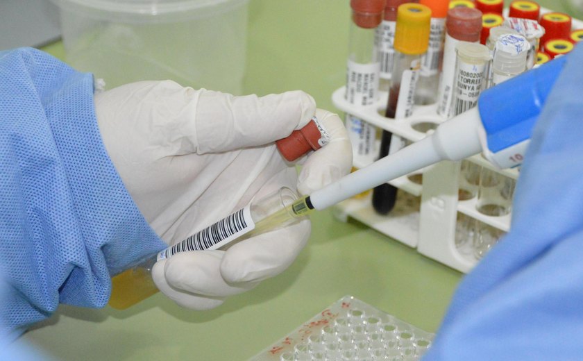 Sesau orienta população sobre riscos, prevenção e tratamento da doença de Chagas