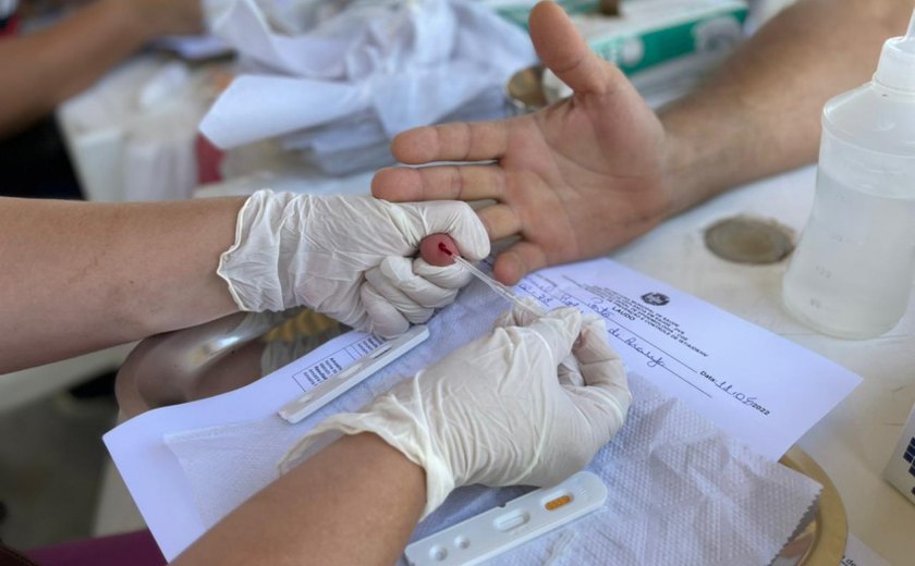 Saúde alerta sobre a importância do teste de HIV para diagnóstico precoce da Aids