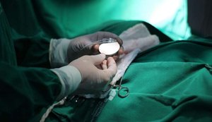 Rede Hospitalar Pública de Alagoas retoma cirurgias cardiovasculares de alta complexidade