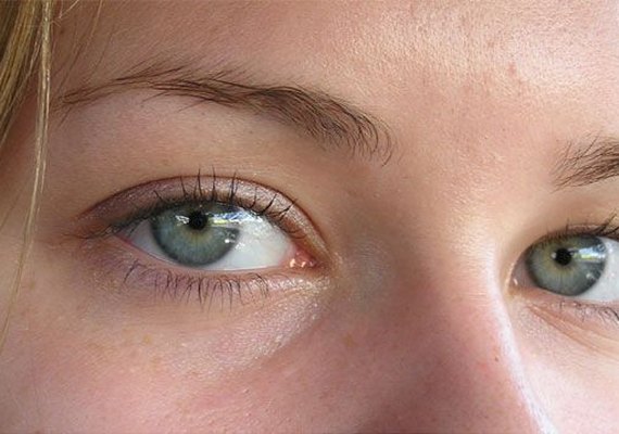 Smartphones podem estar alterando formato dos olhos humanos