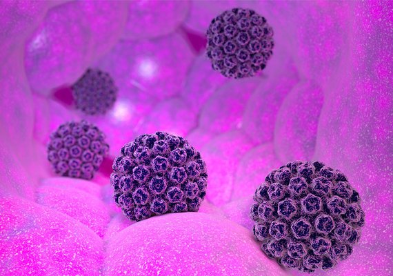 HPV afeta mais de 10 milhões de brasileiros e pode causar mais de cinco tipos de câncer