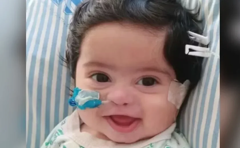 Bebê de 4 meses morre após receber leite na veia por engano em hospital de Pernambuco