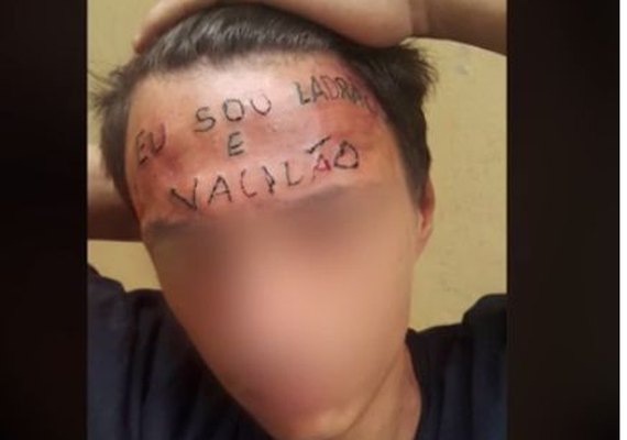 Campanha arrecada R$ 13 mil em um dia para remover tatuagem da testa de jovem